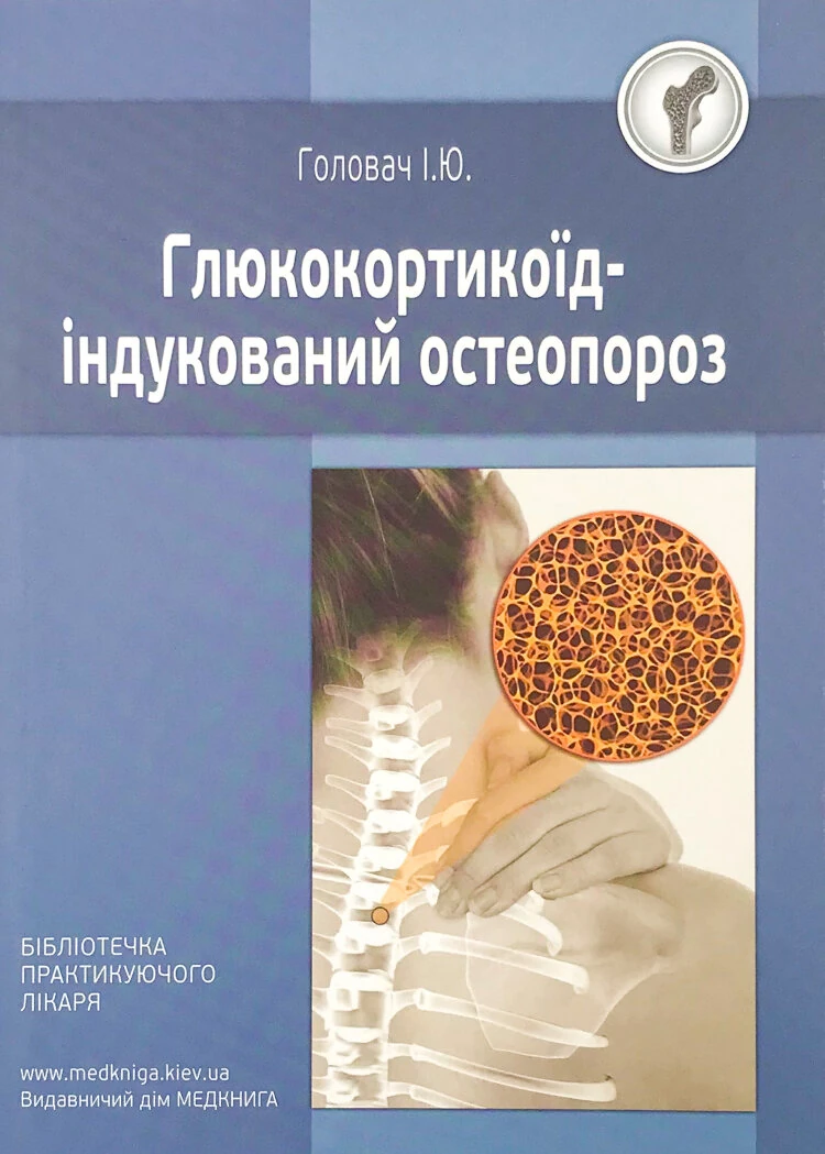 Глюкокортикоїд-індукований остеопороз