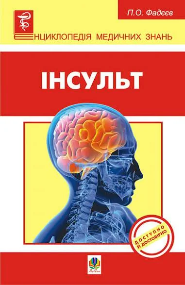 Інсульт