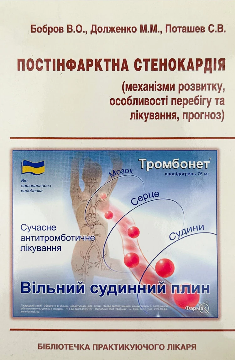 Постінфарктна стенокардія