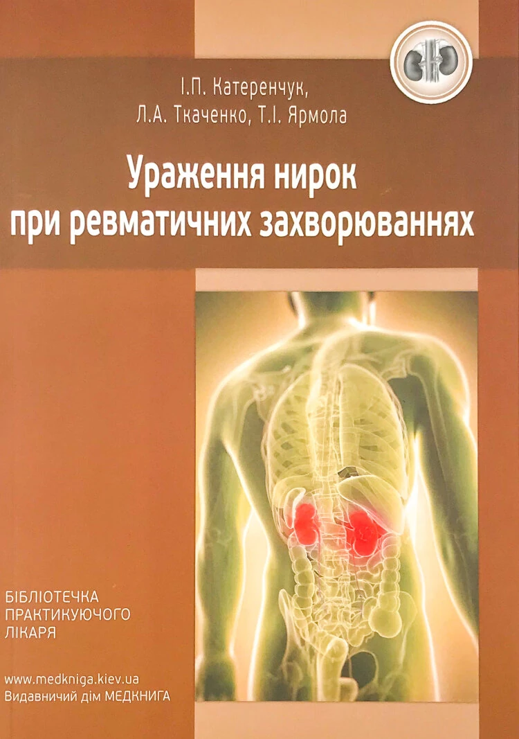Ураження нирок при ревматичних захворюваннях